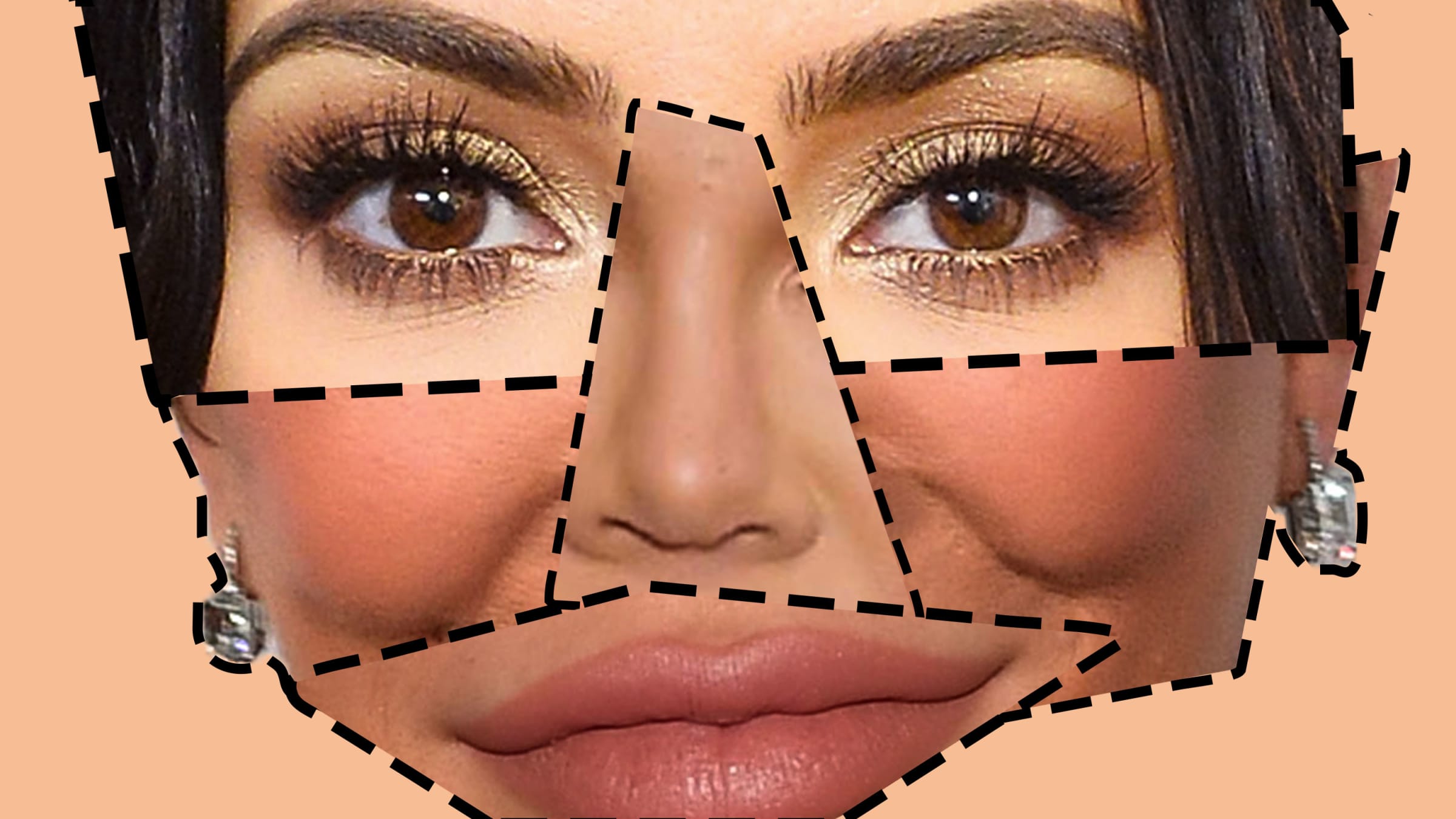 Important Facts When Choosing Your Plastic Surgeon In Dallas Of Means