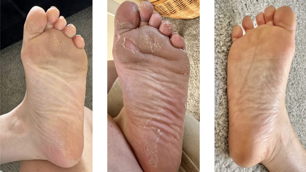 Stacked Skincare Acid Foot Peel Before and After Review