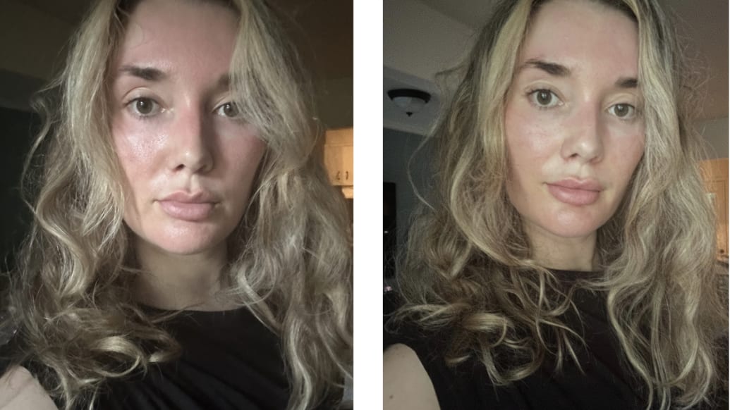 Hypochlorous Acid Before and After Redness