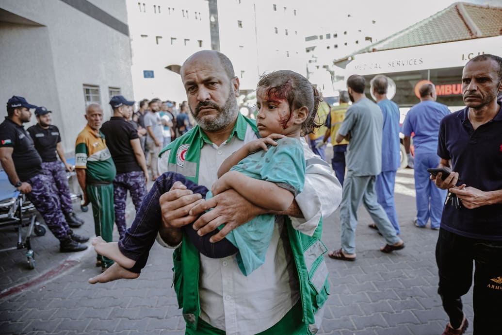 Palestinian child is carried to a hospital during the Israeli bombing of the Gaza Strip on the sixth day of the war on Gaza.
