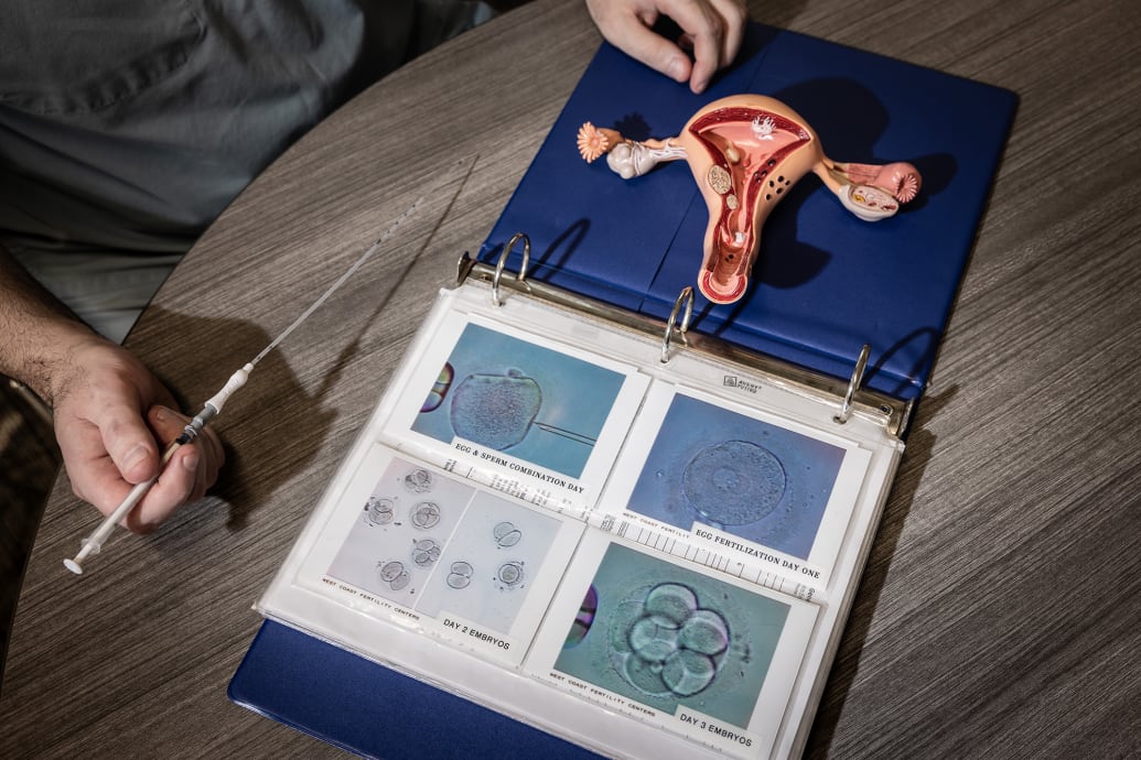 A model of the female reproductive system and an embryo transfer catheter.