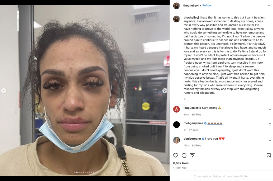 BREAKING: Miles Bridges' wife, Mychelle Williams, posted photos of the  abuse she sustained from her husband this week. ▪️Suffered a…