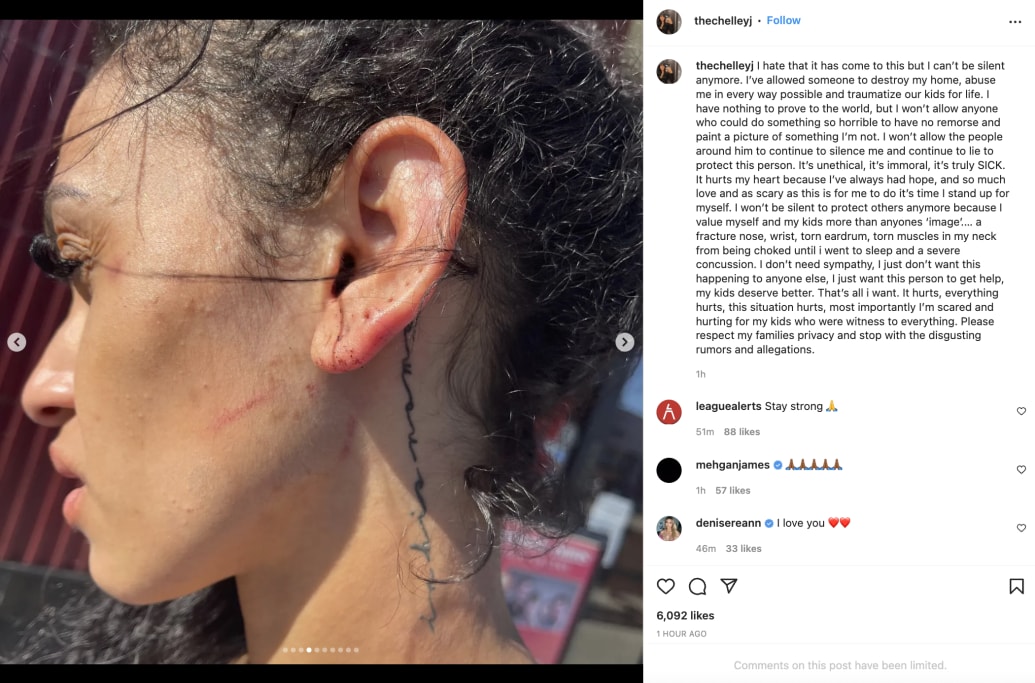 Miles Bridges' wife posts images of injuries over her body - a day after  NBA star turned himself in