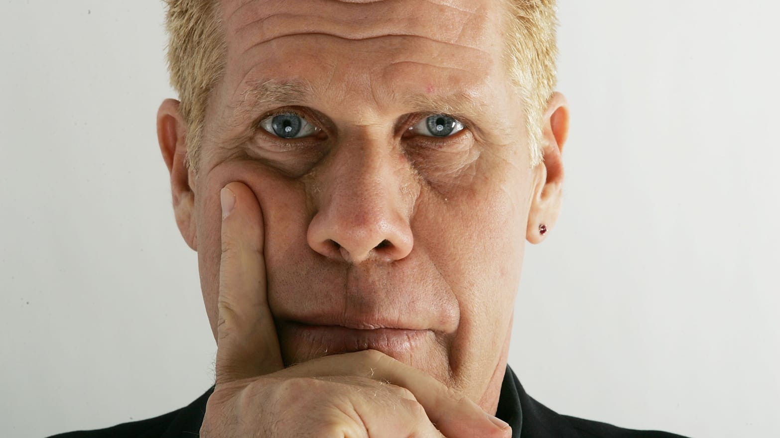 Ron Perlman Face Disease: Is Something Wrong With His Face? 