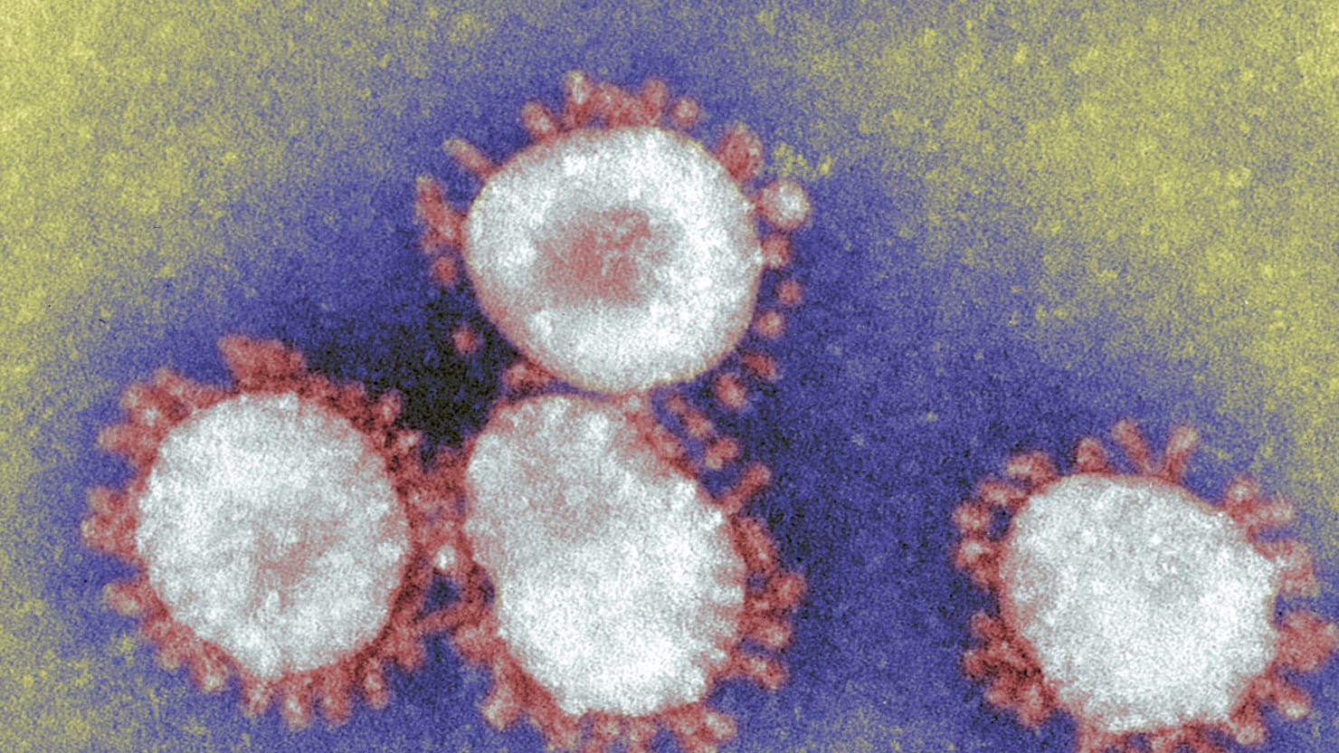 New Virus a 'Threat to the World'