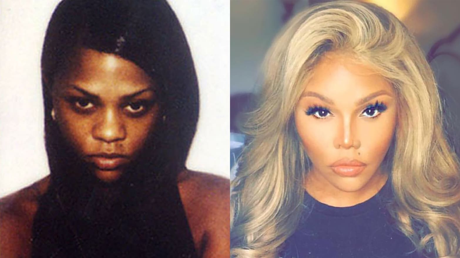 Lil Kim S Lighter Whiter Skin Is A Sad Indictment Of Racism