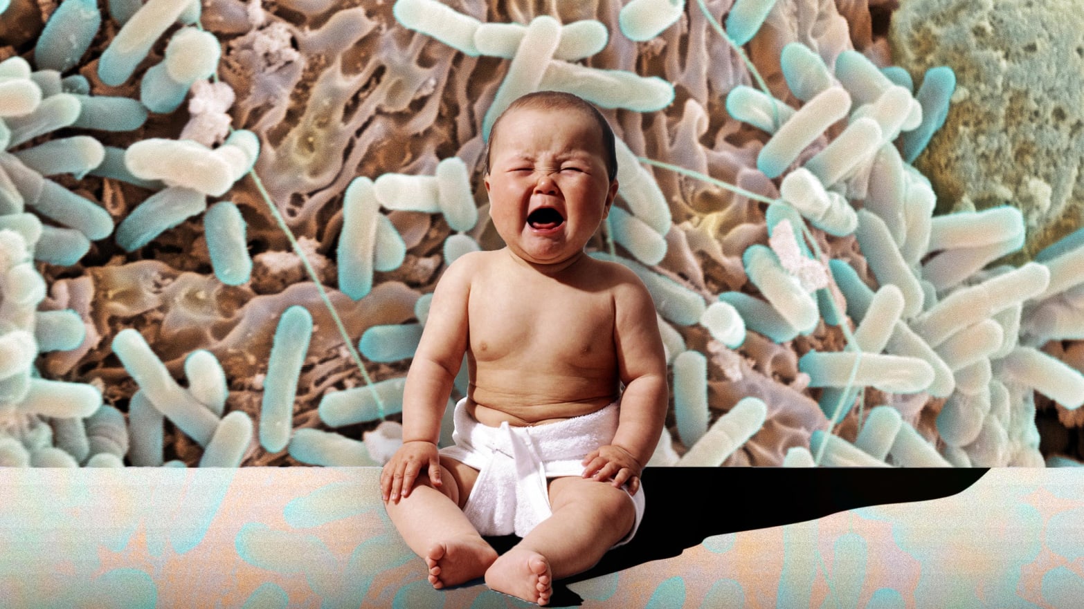 baby in diapers crying in foreground, background is image of bacteria microbiome gut bifidobacteria evolve evivo probiotic