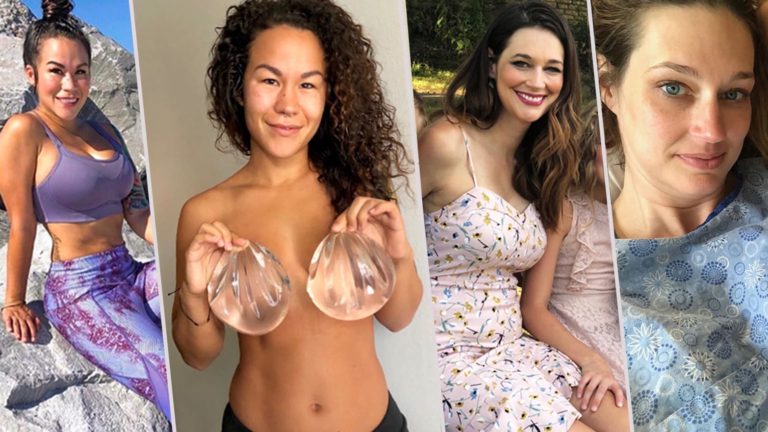Where Women Turn When Doctors Dont Believe Breast Implants Are Making Them