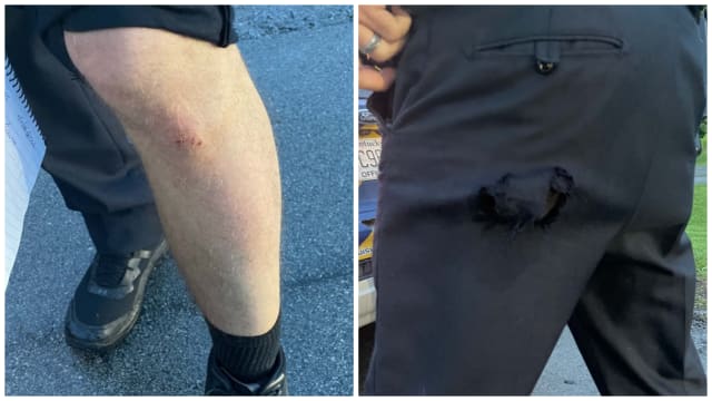 Side-by-side photos of a scraped knee and ripped pants of a Louisville cop.