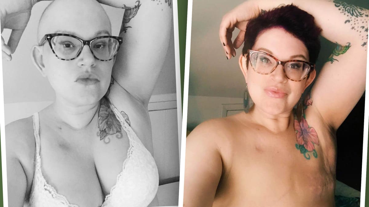 Meet The Badass Breast Cancer Survivors Embracing The Beauty Of 'Going Flat