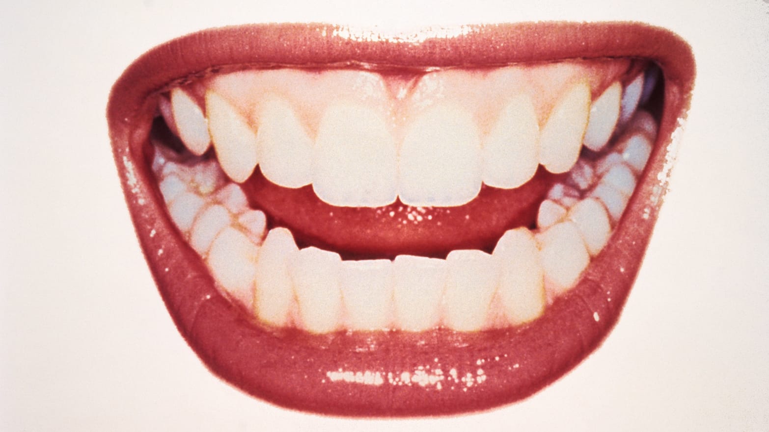 close up of grinning mouth teeth millennial pink gums micro robots microorganism gum dentist dental