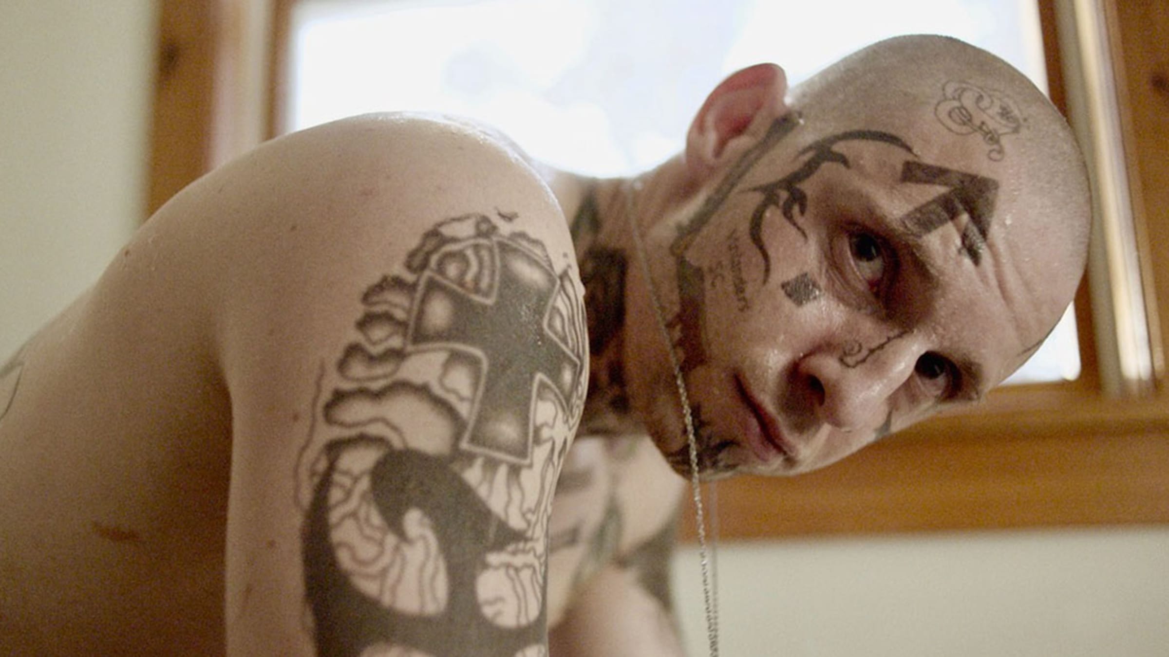 Program erases tattoos to help ex-gang members, sex workers