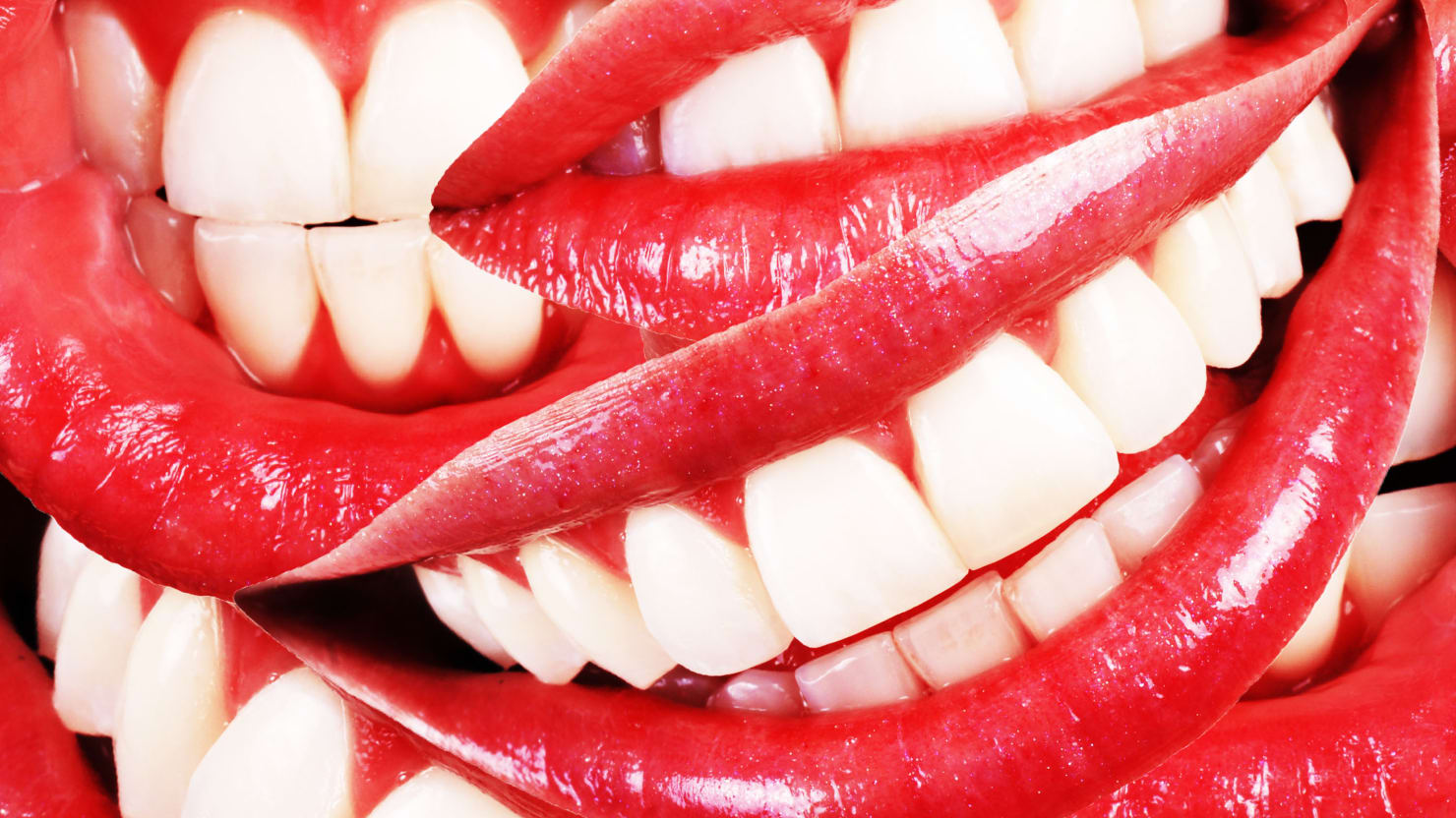 Diy teeth whitening with braces