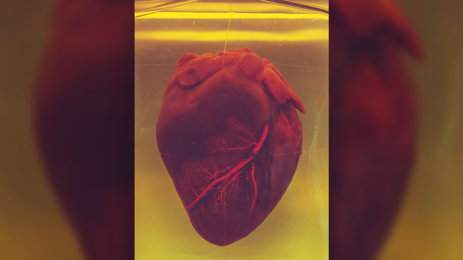 These Miniature Human Heart Organoids Could Help Solve the Organ ...