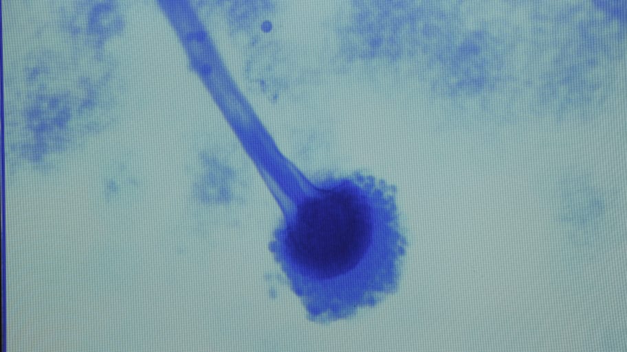 A sample of Aspergillus fumigatus, the first fungus diagnosed in the  fungal meningitis outbreak sweeping the United States, in Nashville.