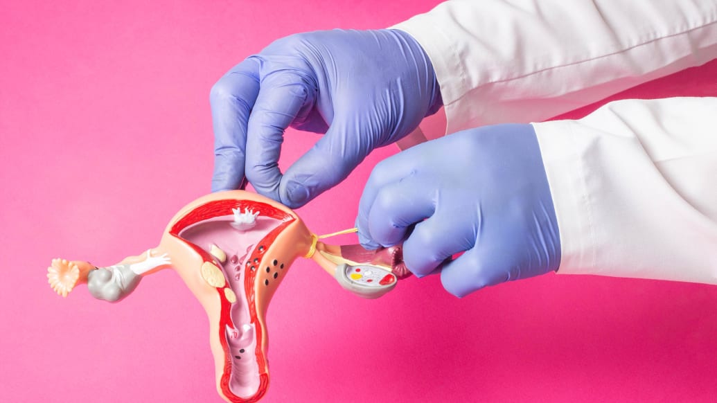 Meet the People Who Won’t Have Sex Until They’re Sterilized
