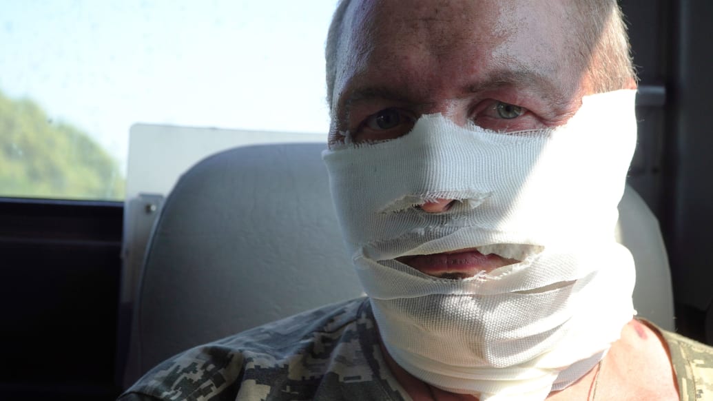 A wounded Ukrainian soldier with bandages on his face.