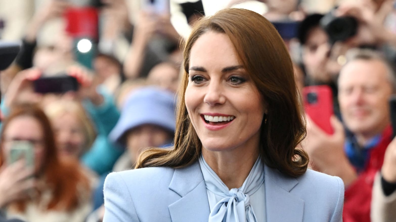 Kate Middleton Hospitalized for Up to 14 Days After Surgery
