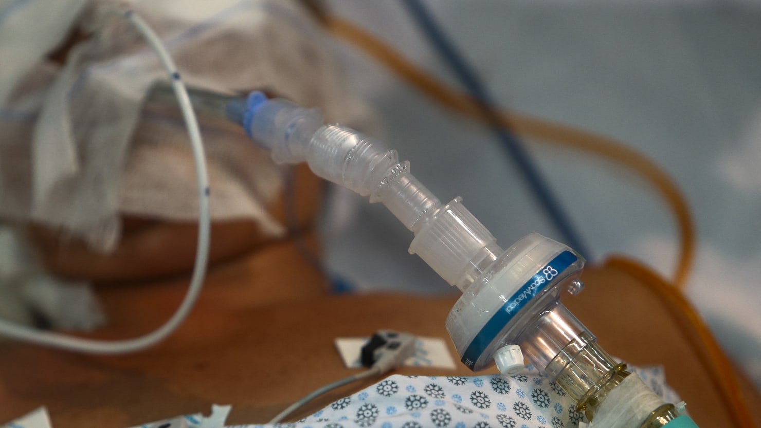 COVID patients in Brazil tied to beds and ventilated without sedatives