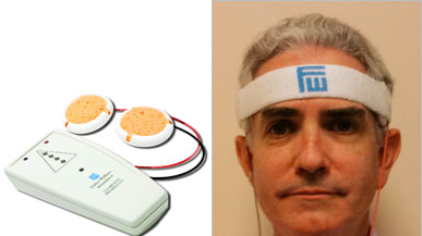 Fisher Wallace Stimulator: Behind the Do-It-Yourself Shock Therapy