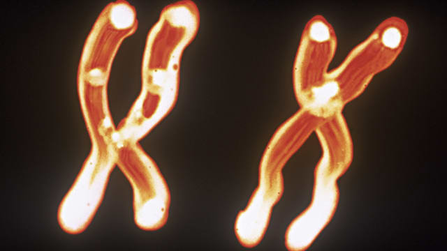 An X and Y chromosome.