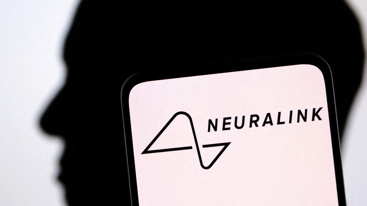 Elon Musk’s neurotech startup Neuralink said Wednesday it has run into problems with a brain chip it implanted into a 29-year-old quadriplegic man e
