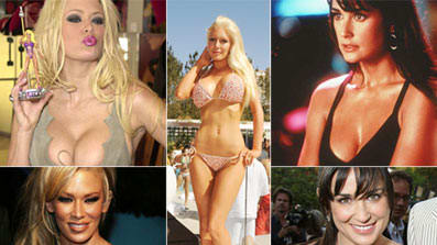 Breast Implant Removal: Heidi Montag, More Plastic Surgery Regrets