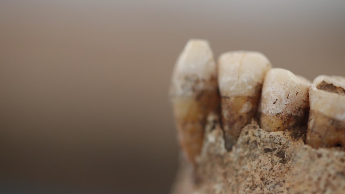 How the Rise of Farming Rotted Ancient Humans’ Teeth