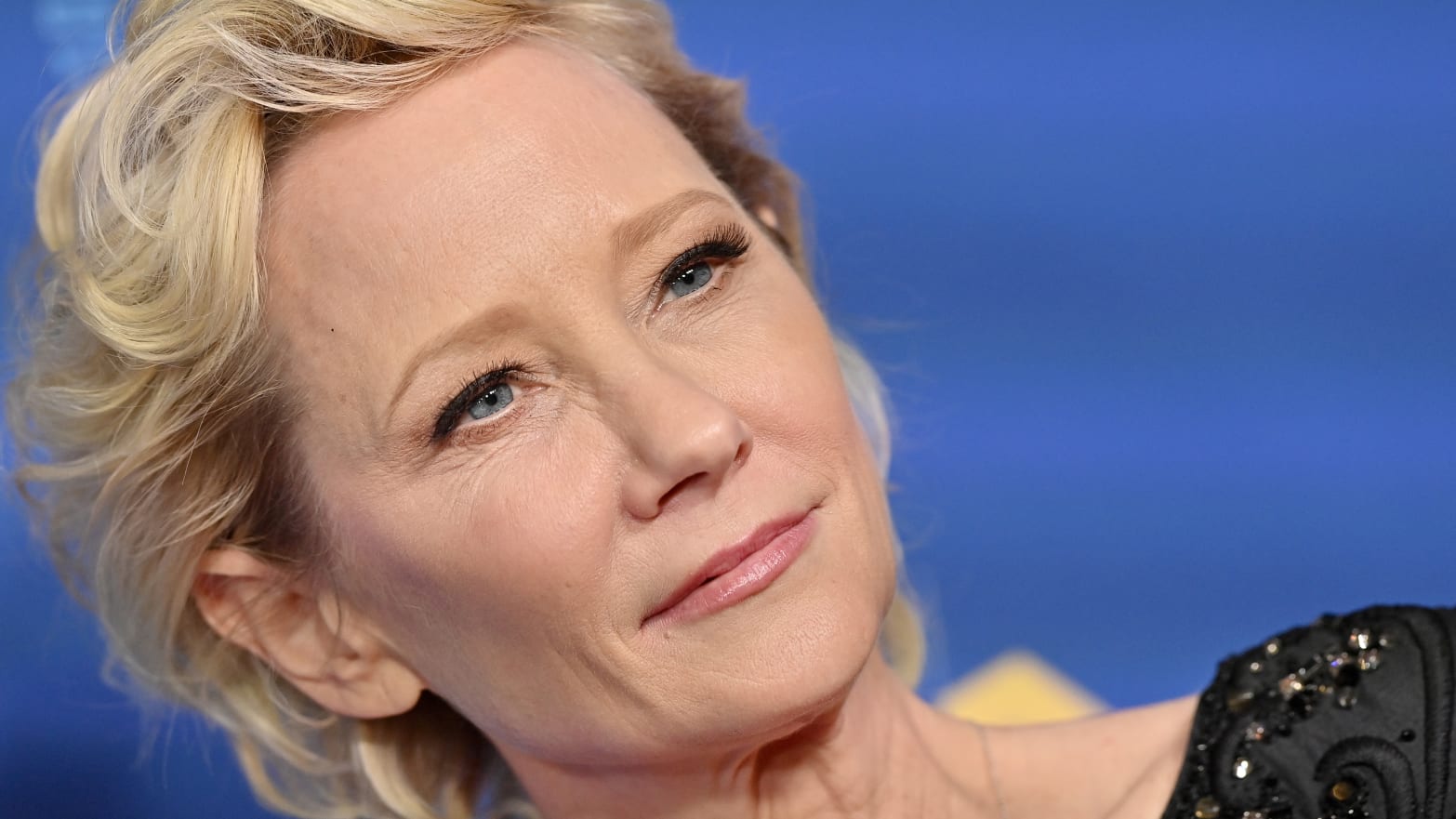 Anne Heche Now in 'Critical Condition' as Details of Wig Purchase Revealed