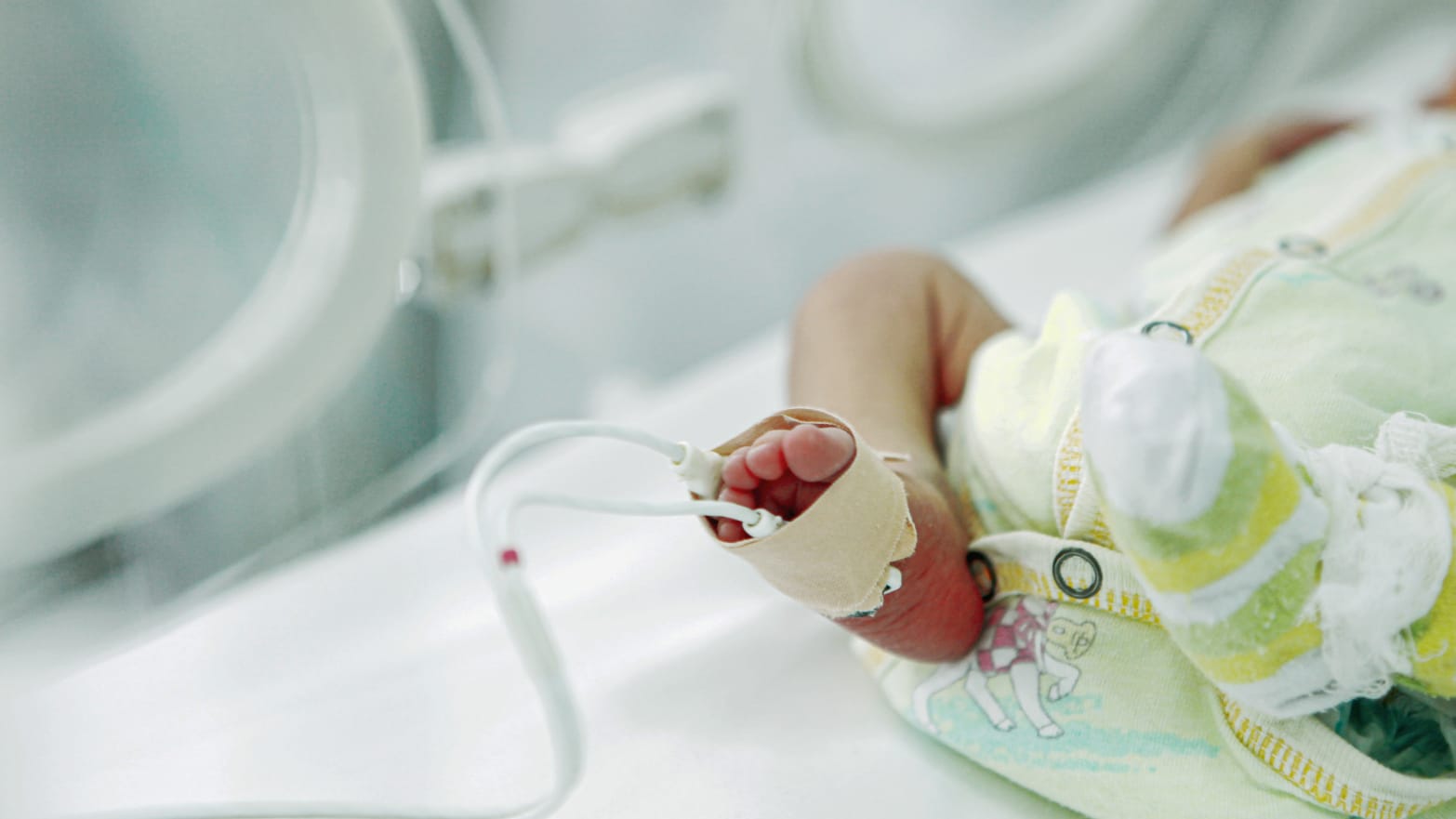 A baby in a neonatal intensive care unit. 