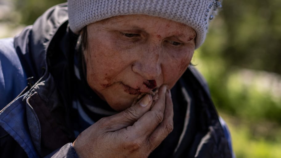 A wounded woman sits outside a train station hit by a Russian military strike in Kherson, Ukraine, May 3, 2023..