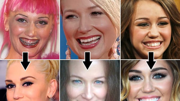 Lindsay Lohan 50 Cent Zac Efron And More Stars Who Fixed Their Teeth
