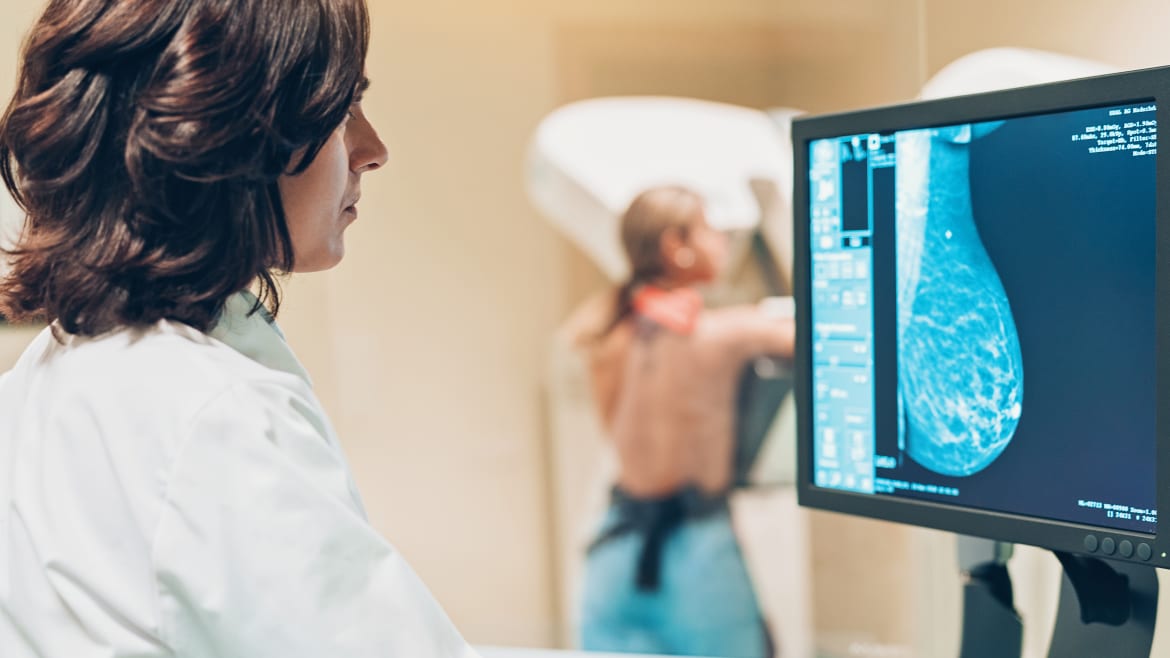 AI Can Help Detect Breast Cancer More Quickly, Study Finds