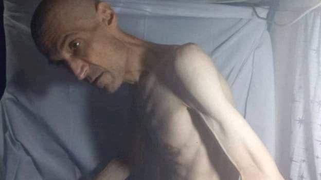 Farhad Meysami lying down on a bed, shown in an emaciated state.