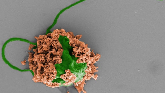Algae With a Secret Surprise Fought Off Deadly Pneumonia