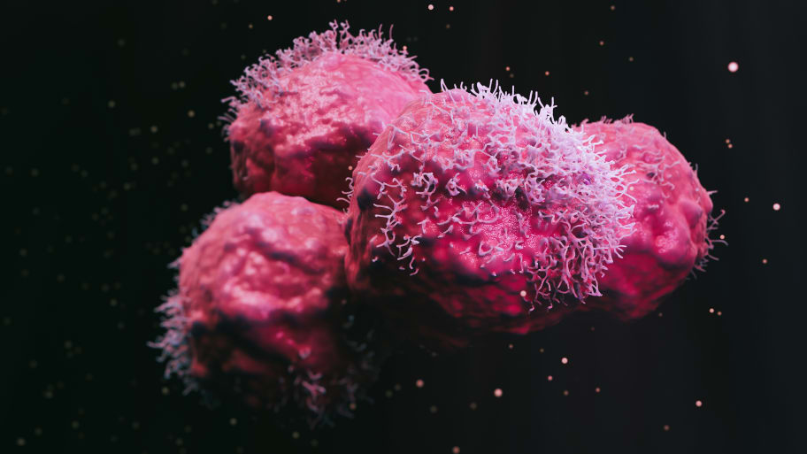 enhanced scanning electron micrograph (SEM) of cancer malignant cells