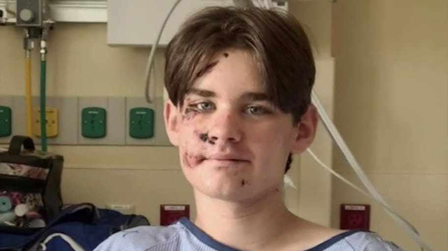 Wyatt Kauffman, 14, survived falling almost 100 feet off a cliff at the Grand Canyon in Arizona. 