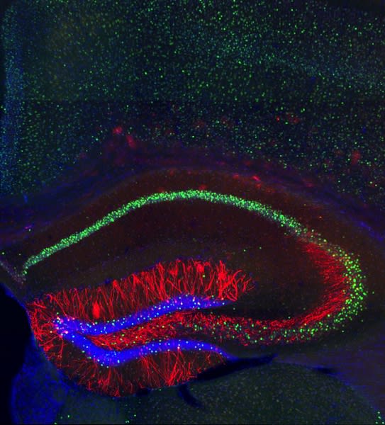 Caption:MIT neuroscientists identified the cells (highlighted in red) where memory traces are stored in the mouse hippocampus.