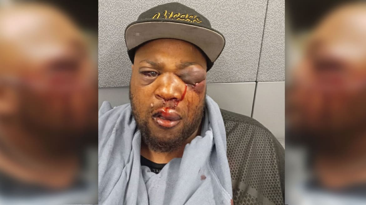 Black Food Truck Owner Savagely Bashed by Man Yelling N-Word, Lawyer Says