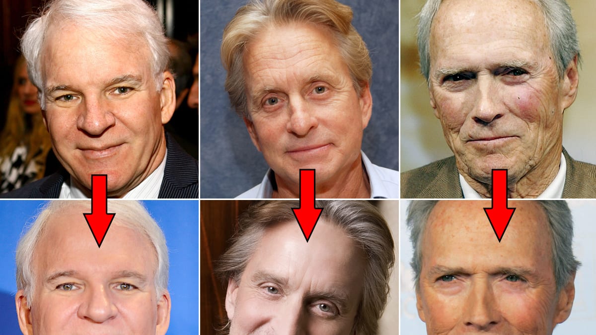 Steve Martin, Simon Cowell, & More Male Celebs Who May Have Had Plastic  Surgery (photos)