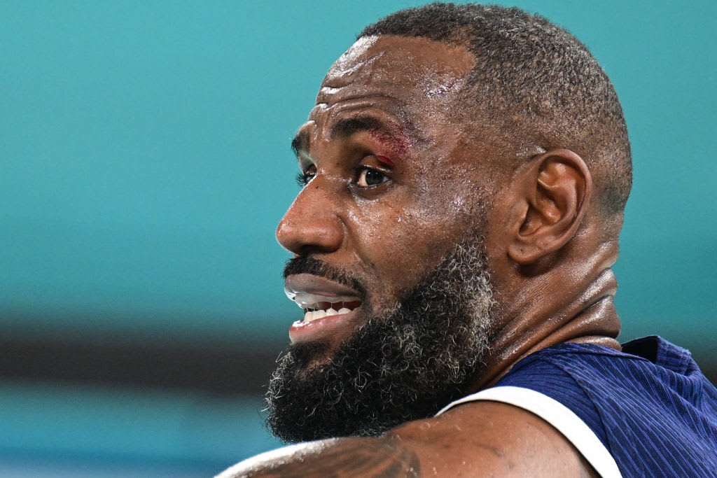 LeBron James sports a gash just above his left eye.