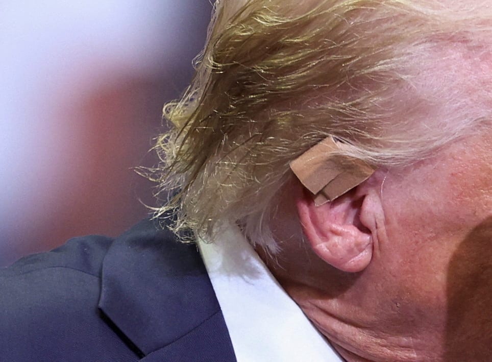 Donald Trump's ear with a small bandage