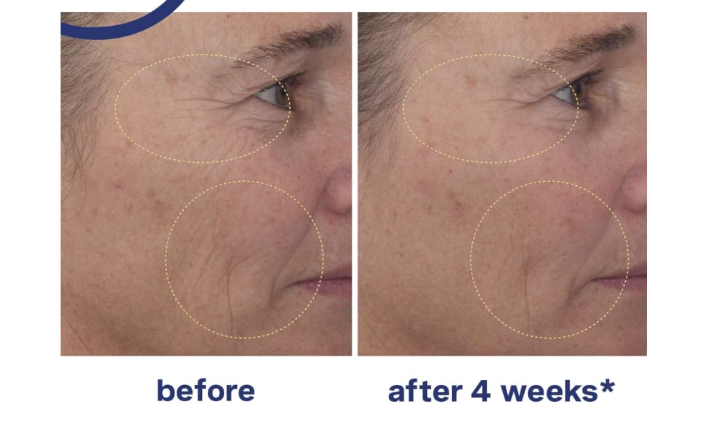 Kate Somerville Mega Transforming Skin Before and After