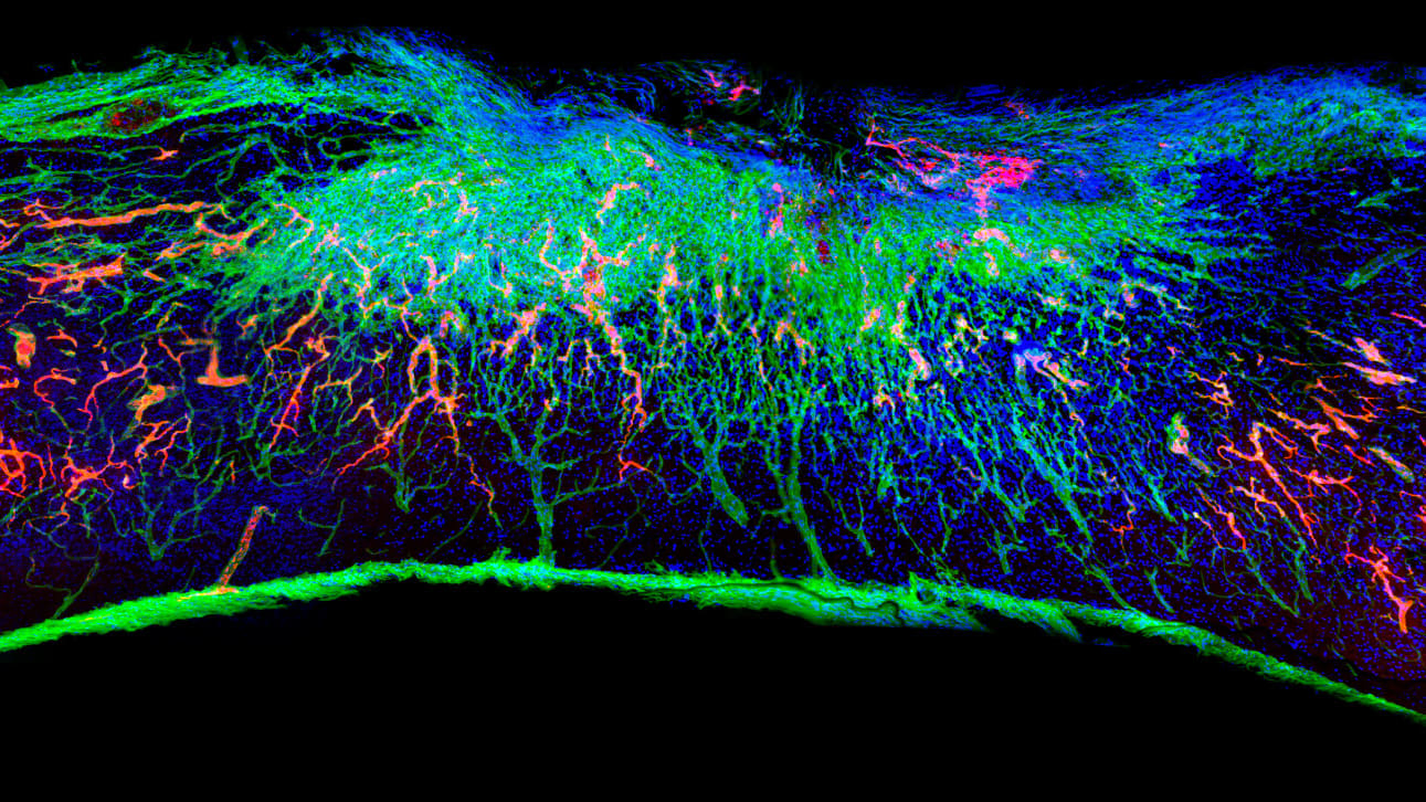 Injectable Gel Reversed Paralysis in Mice With Spinal Cord Injuries